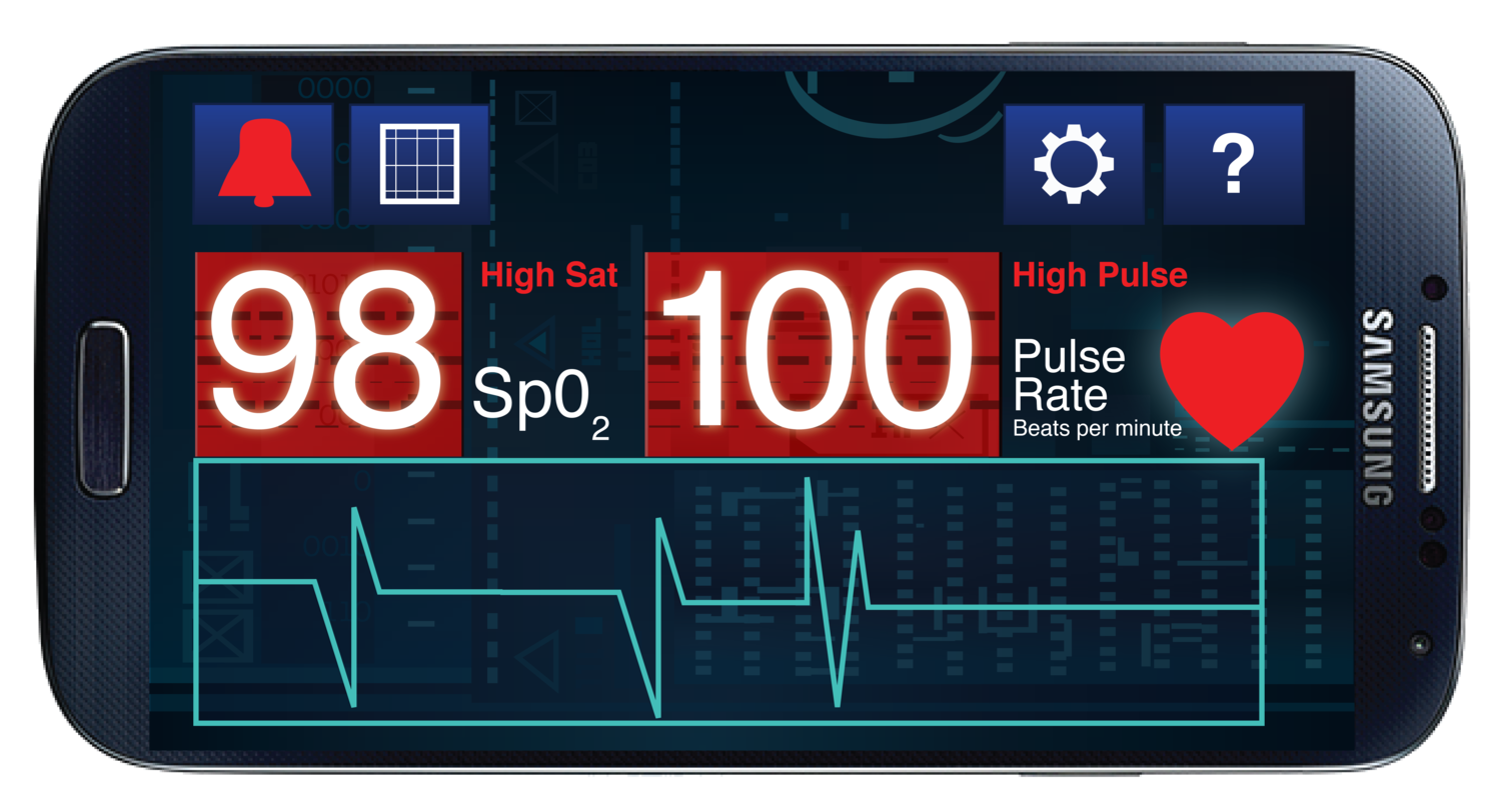 New iOX Smartphone Pulse Oximeter FREE Shipping